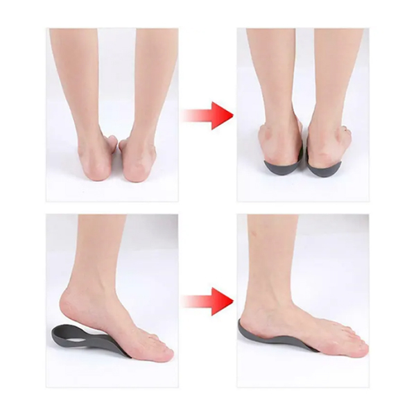 Ортопедические каркасные полустельки с поддержкой свода стопы 09-908 4