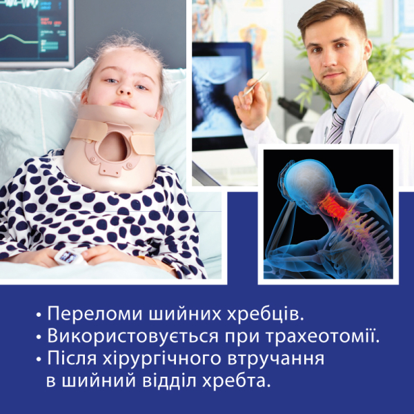 Бандаж для шийних  хребців  "Філадельфія" з отвором для трахеї (дитячий), Тип 711 3